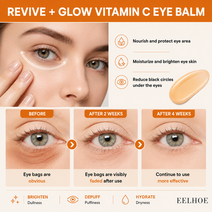 Vitamin C Under Eye Roller | Dark Circles & Puffiness